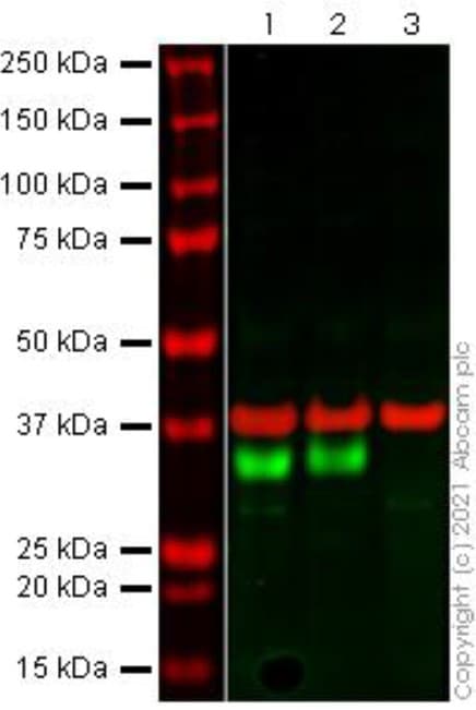 Anti-HLA-DR antibody [TAL 1B5](AB20181)