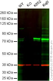 Syk Antibody Ep573y Ab40781  Western Blot Img2836