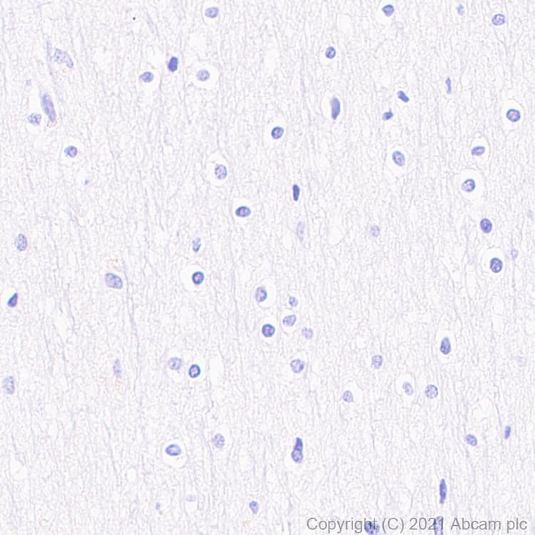 Cxcr6 Antibody Epr24686 113 Bsa And Azide Free Ab281934  Immunohistochemistry Formalin Pfa Fixed Paraffin Embedded Sections Img180932