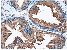 Pank2 Antibody Oti3h9 Ab119070  Immunohistochemistry Formalin Pfa Fixed Paraffin Embedded Sections Img55611