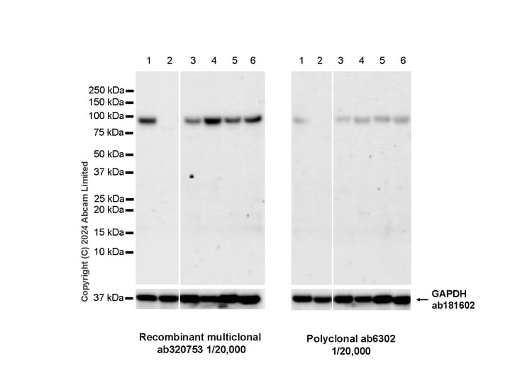 Anti-beta Catenin antibody(AB6302)