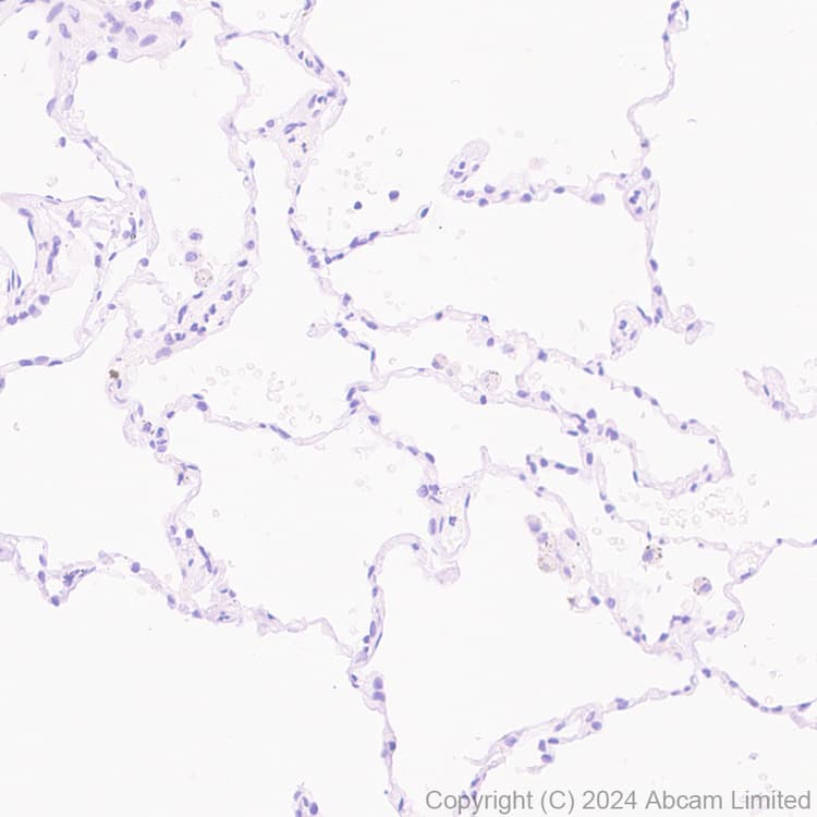 Anti-TRPA1/TSA antibody [EPR26211-139] - BSA and Azide free(AB320716)