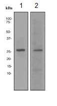 Anti-p27 KIP 1 antibody [EPFHCR16a](AB113075)