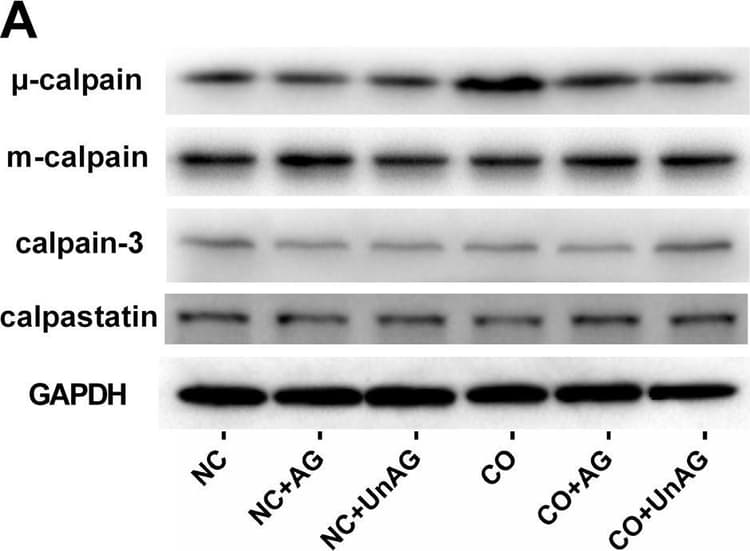 Calpain 1 Antibody Epr3319 Ab108400  Western Blot Img443304