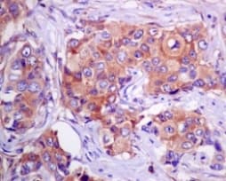 Eef1a1 Ef Tu Eef1a1 Ee1al3 Eef1a1p5 Antibody Epr9470 Ab140632  Immunohistochemistry Formalin Pfa Fixed Paraffin Embedded Sections Img128716