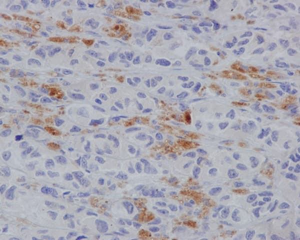 Anti-MLKL (phospho S358) antibody [EPR9514](AB187091)