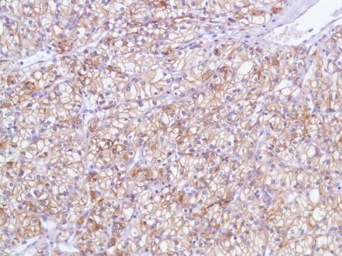 Egfr Antibody Sp84 Bsa And Azide Free Ab238803  Immunohistochemistry Formalin Pfa Fixed Paraffin Embedded Sections Img124036