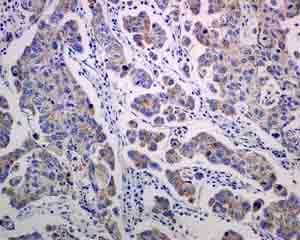 Mrps15 Antibody Epr9361 Ab137070  Immunohistochemistry Formalin Pfa Fixed Paraffin Embedded Sections Img99115