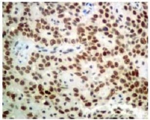 Anti-Nuclear Matrix Protein p84 antibody [EPR5662(2)] - BSA and Azide free(AB232034)