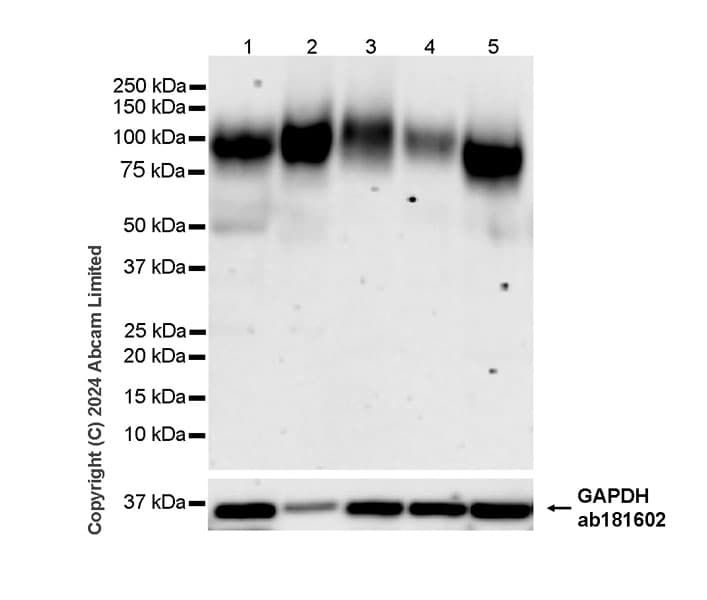 Anti-LAMP1 antibody [RM1217](AB320851)