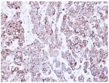 Rrbp1 Antibody Ab95983  Immunohistochemistry Formalin Pfa Fixed Paraffin Embedded Sections Img56417