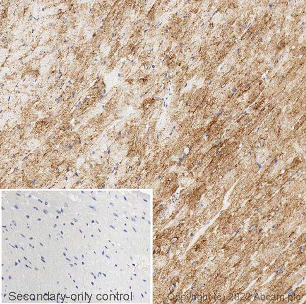 Anti-Glucose Transporter GLUT4 antibody(AB33780)