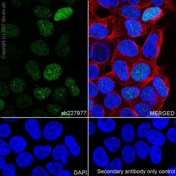 Anti-FOXC1 antibody [EPR20685](ab227977)
