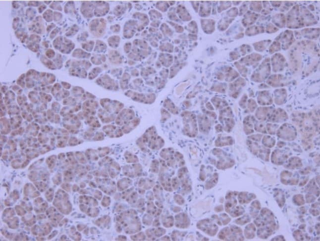 Anti-IGF1+IGF2 antibody(ab9572)