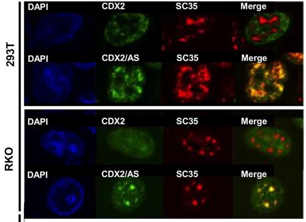 Anti-SC35 antibody [SC-35] - Nuclear Speckle Marker(AB11826)