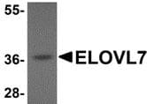 Elovl7 Antibody Ab106633  Western Blot Img40401