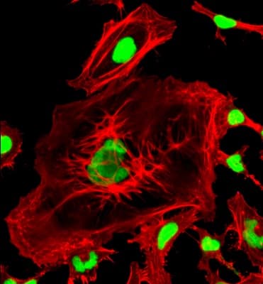 Phalloidin-iFluor 555 Reagent(AB176756)