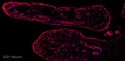 Donkey Anti-Rabbit IgG H&L (Alexa Fluor® 647)(AB150075)