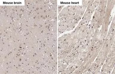 Rgs4 Antibody Hl1522 Ab308160  Immunohistochemistry Formalin Pfa Fixed Paraffin Embedded Sections Img440687