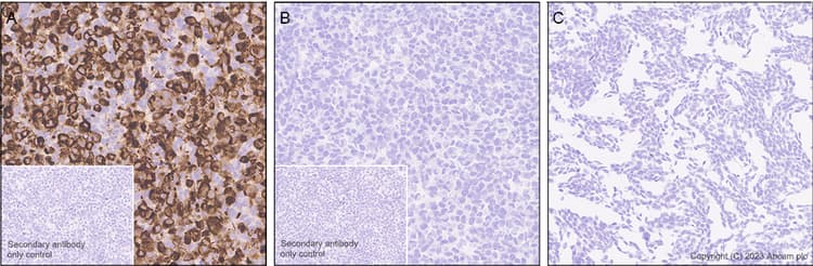 Egfrviii Antibody Epr28380 83 Bsa And Azide Free Ab313647  Immunohistochemistry Formalin Pfa Fixed Paraffin Embedded Sections Img418460