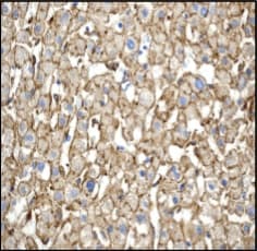 Anti-LRP1 antibody [EPR3724](AB92544)