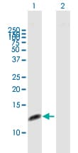 Rpa14 Rpa3 Antibody Ab167593  Western Blot Img19254