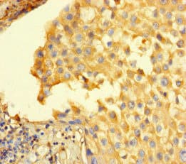 Stil Sil Antibody Ab222838  Immunohistochemistry Formalin Pfa Fixed Paraffin Embedded Sections Img126175