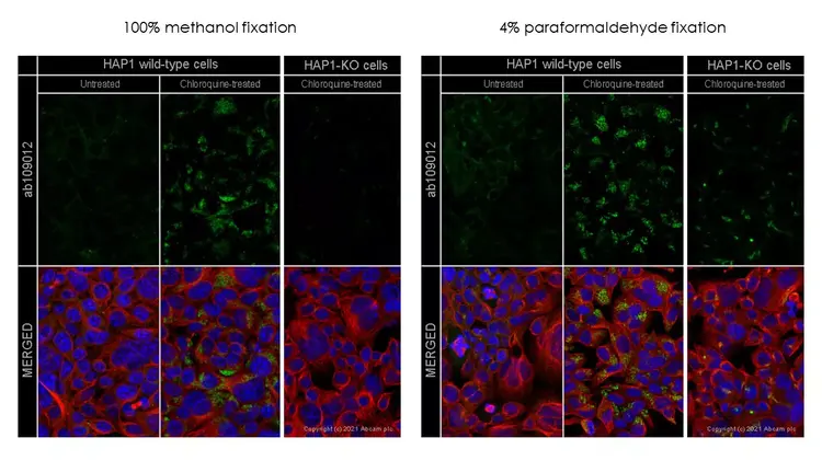 Anti-SQSTM1 / p62 antibody [EPR4844] - Autophagosome Marker(AB109012)
