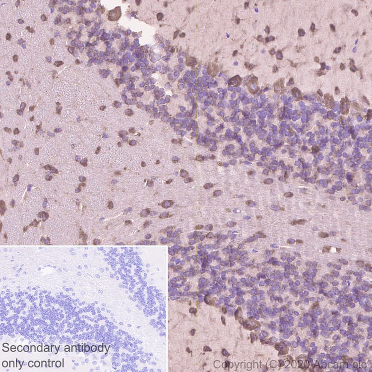 Anti-SCA2 antibody [EPR23630-49] - BSA and Azide free(ab275752)