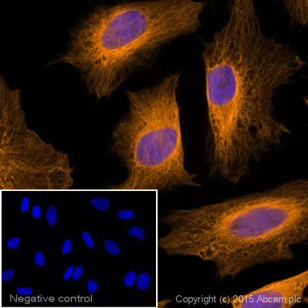 Goat Anti-Rabbit IgG H&L (Alexa Fluor® 594)(AB150080)