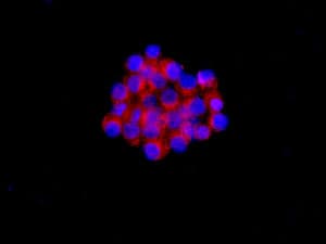 Superoxide Dismutase 4 Ccs Antibody Epr9712 Bsa And Azide Free Ab249412  Immunocytochemistry Immunofluorescence Img964
