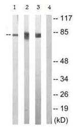 Anti-PKC epsilon (phospho S729) antibody(AB63387)