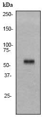 Anti-Cytokeratin 10 antibody [EP1607IHCY] - Cytoskeleton Marker(AB76318)