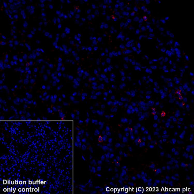 Alexa Fluor 555 Granzyme B Antibody Epr22645 206 Ab308602  Immunohistochemistry Formalin Pfa Fixed Paraffin Embedded Sections Img409018