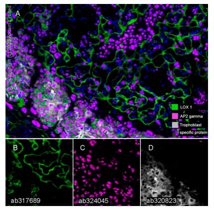 Lox 1 Antibody Epr27871 67 Bsa And Azide Free Ab317690  Multiplex Immunohistochemistry Img450126