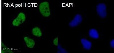 Anti-RNA polymerase II CTD repeat YSPTSPS antibody - ChIP Grade(AB26721)