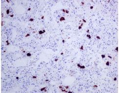Tsh Beta Antibody Epr8198 Bsa And Azide Free Ab249213  Immunohistochemistry Formalin Pfa Fixed Paraffin Embedded Sections Img112637