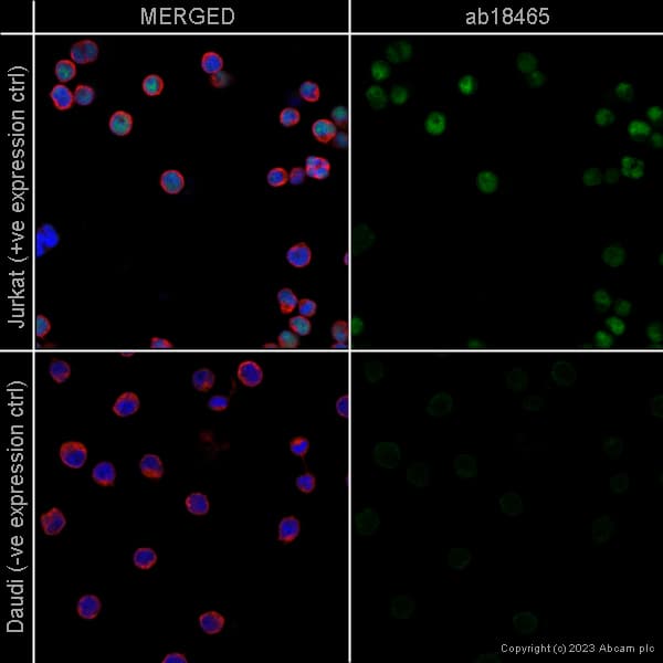 Anti-beta Tubulin antibody - Loading Control(AB6046)