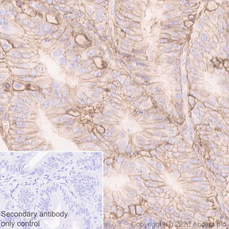 Anti-CD44 antibody [EPR18668](AB189524)