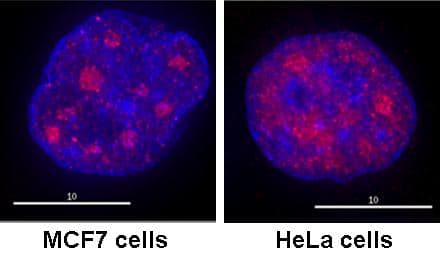 Anti-RNA polymerase II CTD repeat YSPTSPS (phospho S2) antibody(AB5095)