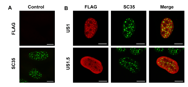 Anti-SC35 antibody [SC-35] - Nuclear Speckle Marker(AB11826)