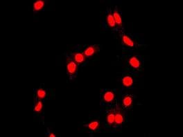 Anti-Topoisomerase I antibody [EPR5375](AB109374)