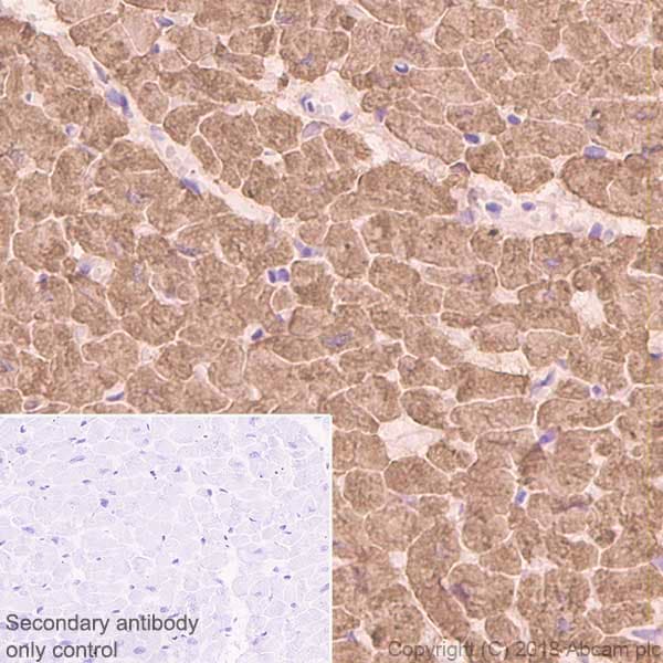 Anti-Cardiac Troponin I antibody [EP1106Y](AB52862)