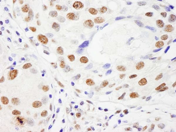 Numa Antibody Ab241470  Immunohistochemistry Formalin Pfa Fixed Paraffin Embedded Sections Img76842