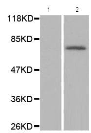 Anti-PKC beta 1 + PKC beta 2 (phospho T641) antibody(AB194749)