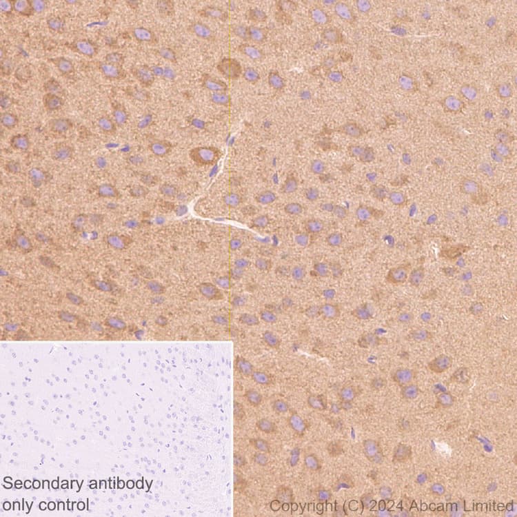 Mtor Antibody Rm1258 Ab322444  Immunohistochemistry Formalin Pfa Fixed Paraffin Embedded Sections Img438198