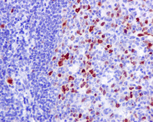 Nucleolin Phospho T76 Antibody Epr8080 2 Ab168363  Immunohistochemistry Formalin Pfa Fixed Paraffin Embedded Sections Img141199