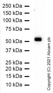 Anti-Nicotinic Acetylcholine Receptor beta/CHRNB1 antibody [EP2067Y](AB76159)