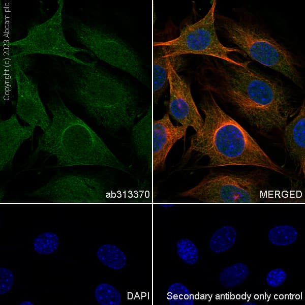 Anti-KPNB1 antibody [EPR26137-52](AB313370)
