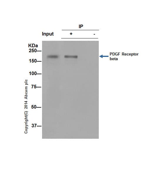Anti-PDGFR alpha + PDGFR beta antibody [Y92] - C-terminal(AB32570)